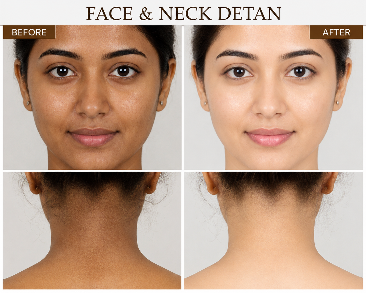 Face Neck & Back Detan - O3+