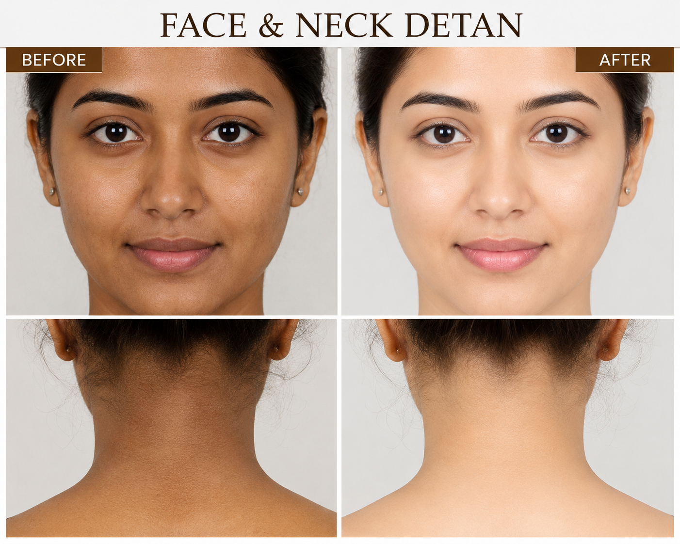Face Neck & Back Detan - O3+